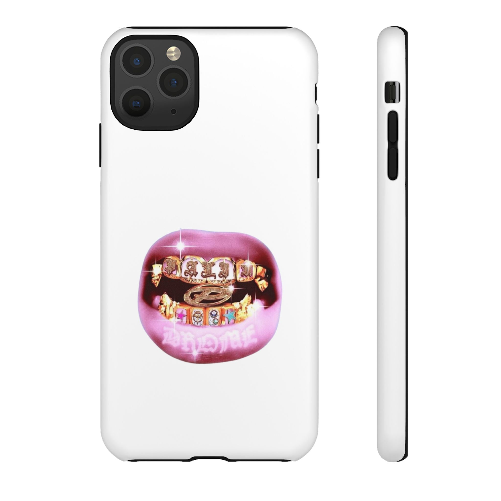 Pink Grillz Phone Case