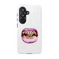 Pink Grillz Phone Case